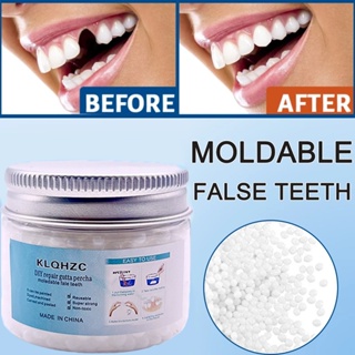 Shop moldable false teeth for Sale on Shopee Philippines