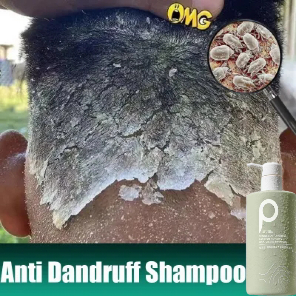 Sea Salt Anti-Dandruff Shampoo Deep cleaning, get rid of dandruff, anti ...