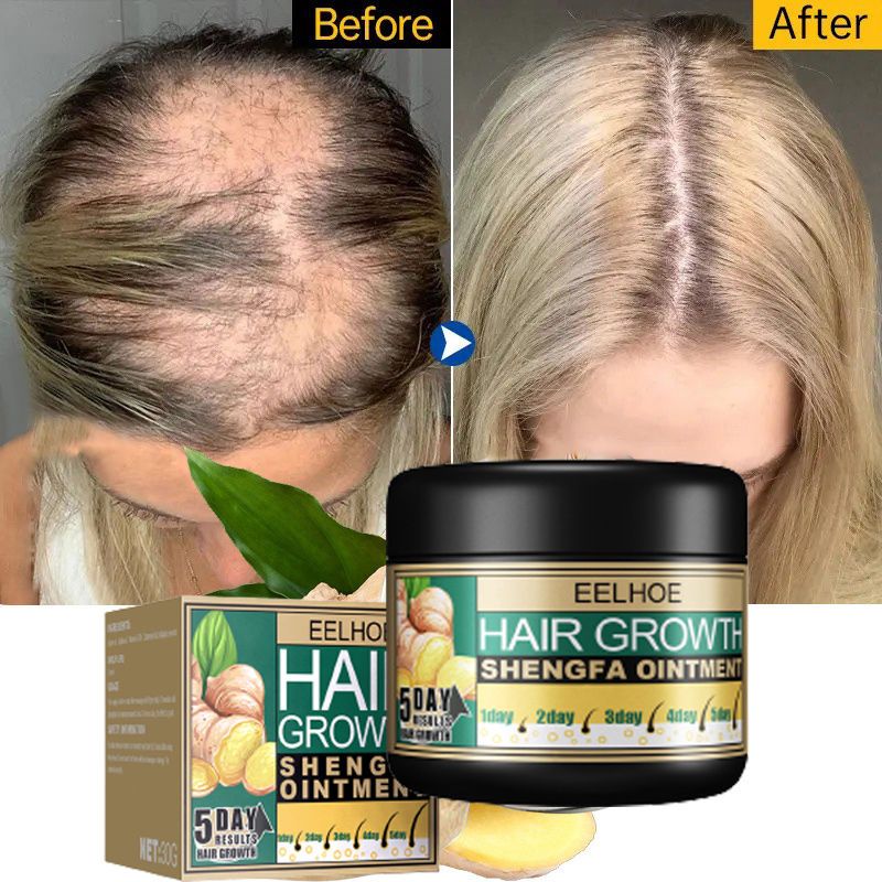 Ginger Conditioner Hair Growth Cream Fast Growing Hair Loss Repair Care Ointment Hair Deep 9513