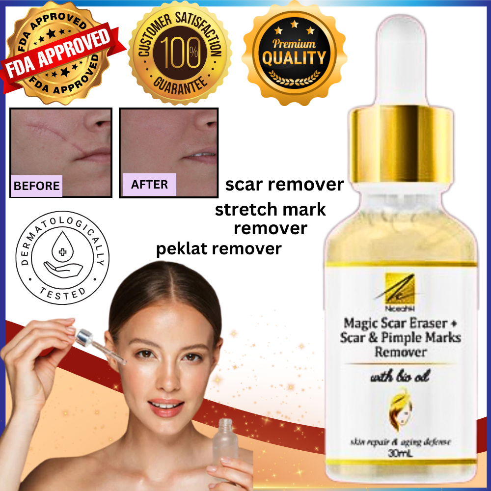 Magic Scar: Original Melasma & Stretch Mark Remover Cream (Serum ...