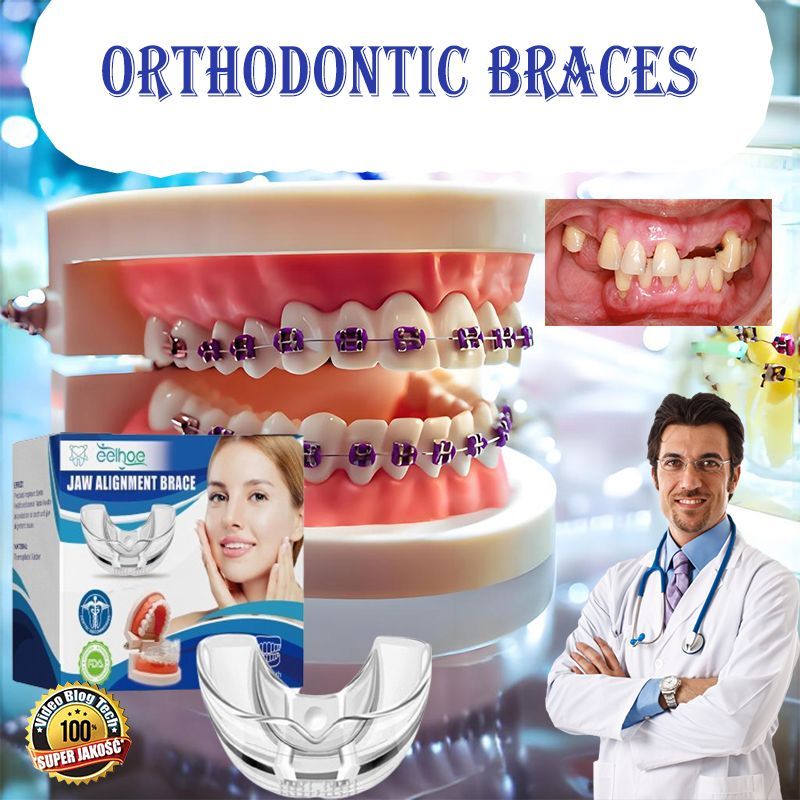 Dental Tooth Orthodontic Appliance Teeth Alignment Teeth Aligner