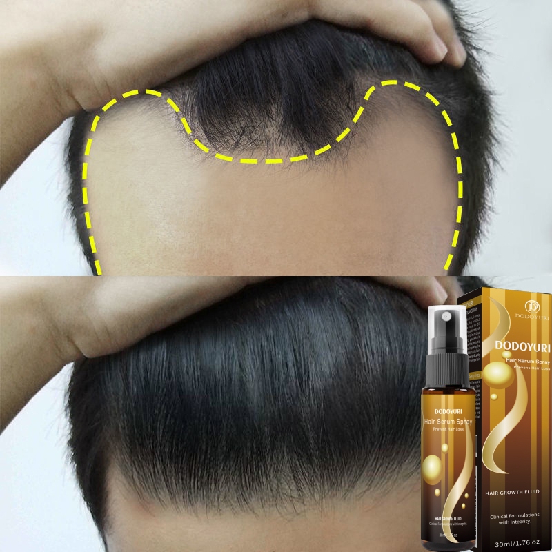 100% Effective hair growth serum fast hair growth hair grower for man ...