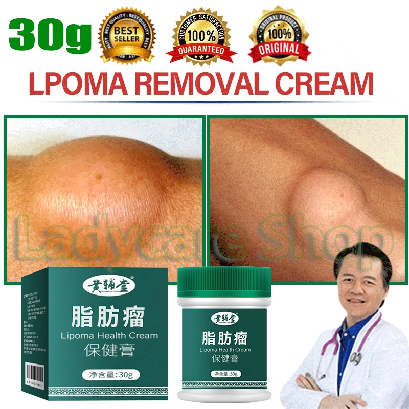 Lipoma Ointment Cream Original Lipoma Removal Cream Treat Tumor Skin Swelling Herbal Treatment 