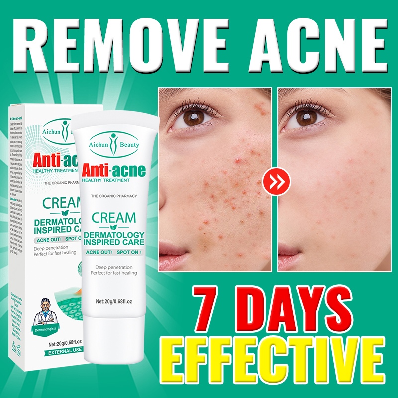 Acne Remover Cream Pimple Marks Remover Cream Acne Treatment Acne Scar