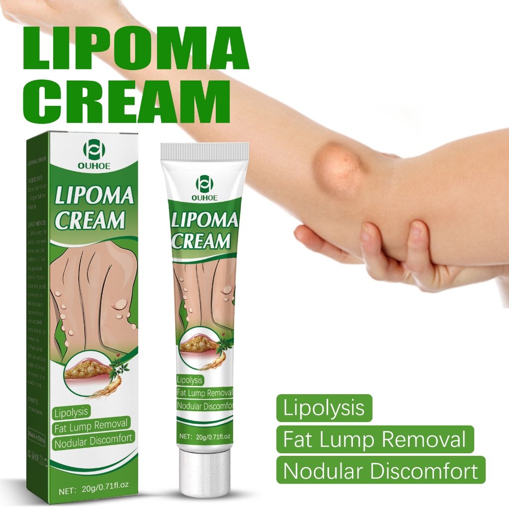Lipoma Lumps Removal Cream Lipoma Reduce Swelling and Fatty Lumps