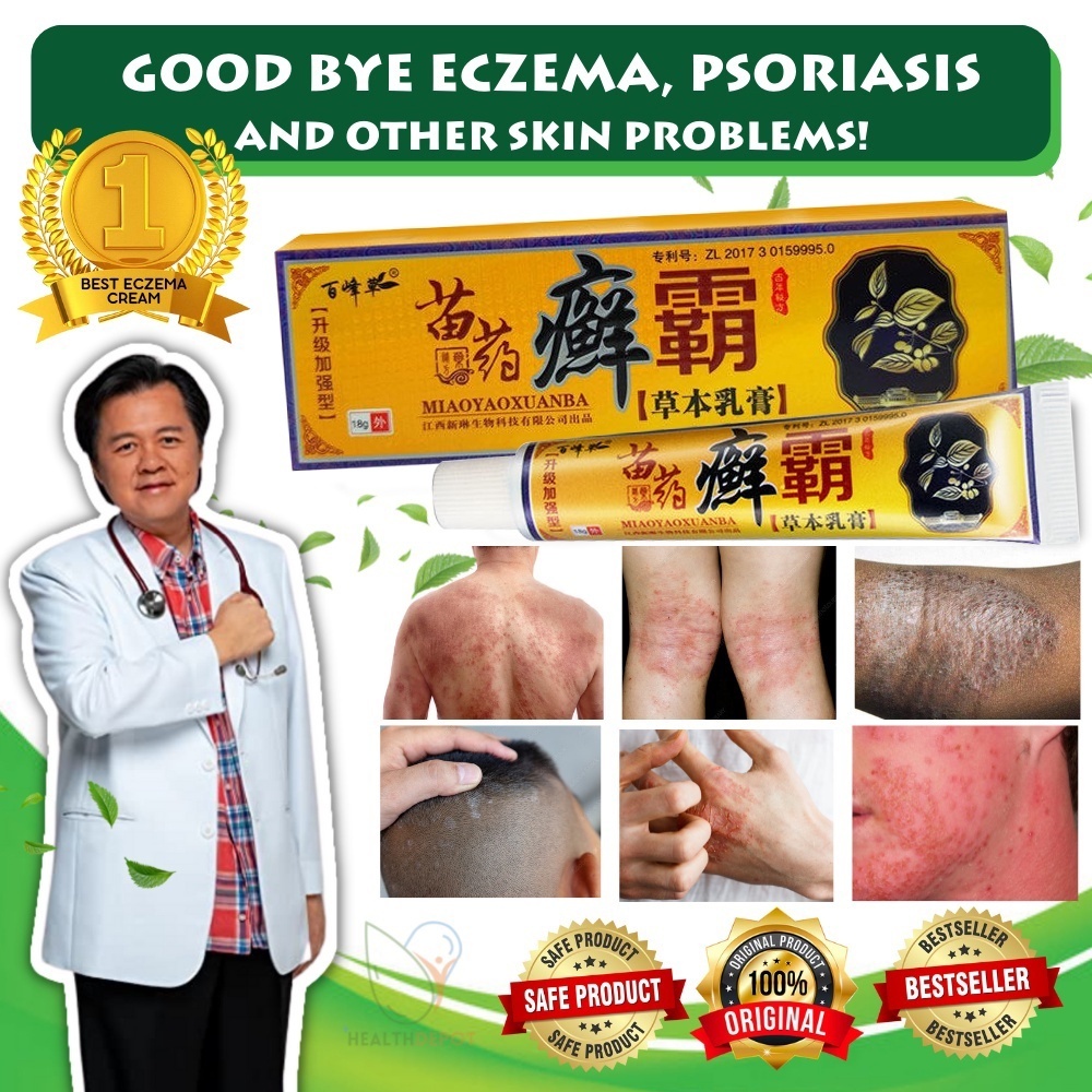Psoriasis Eczema Cream For Skin Problems Patch Chinese Herbal Medicin ...