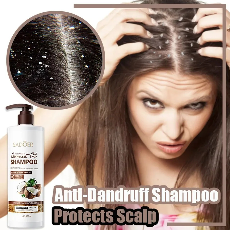 Anti Dandruff Shampoo Coconut Oil Shampoo Scalp Treatment for Dandruff