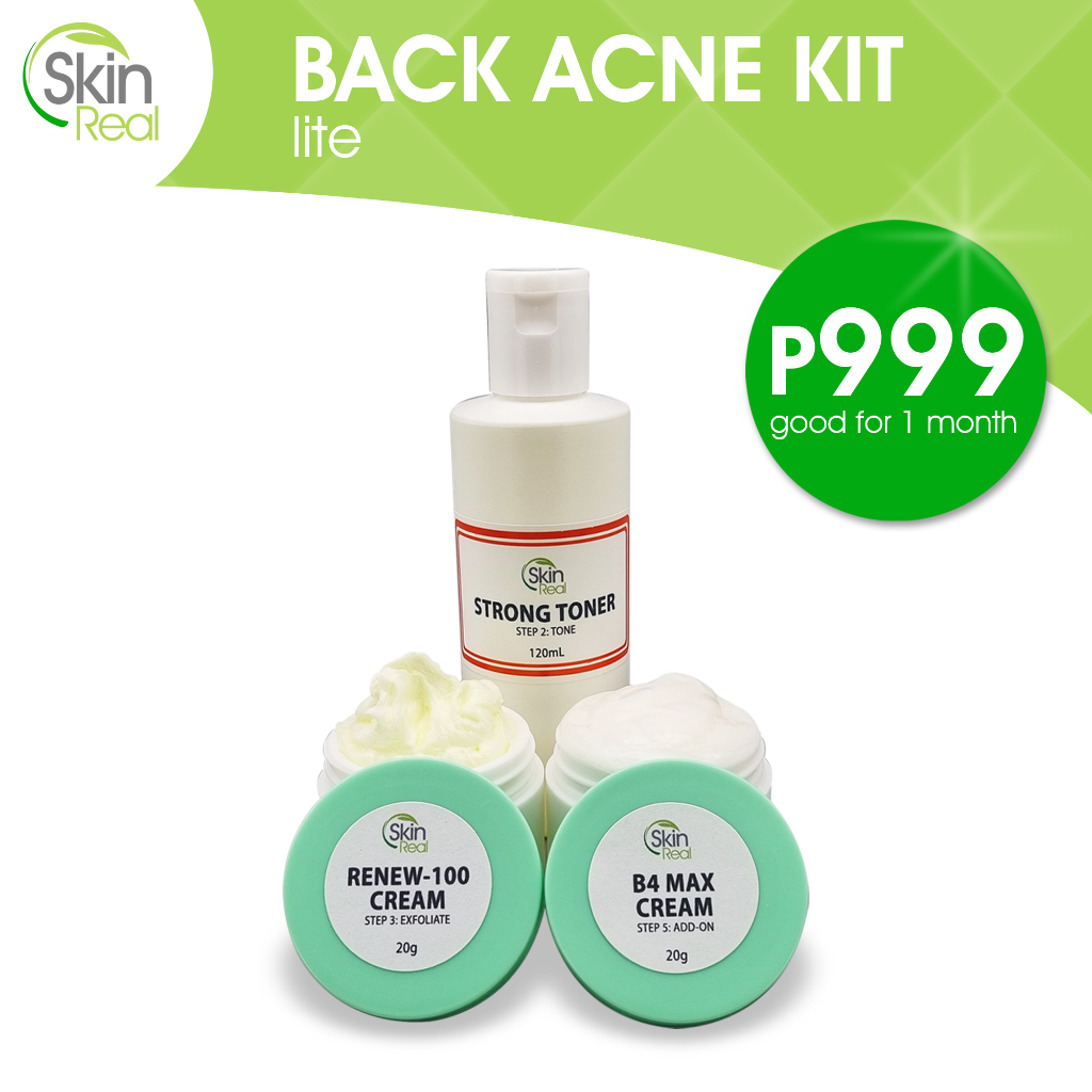 BACK ACNE KIT by SkinReal PH | variants: lite, maintenance, starter ...