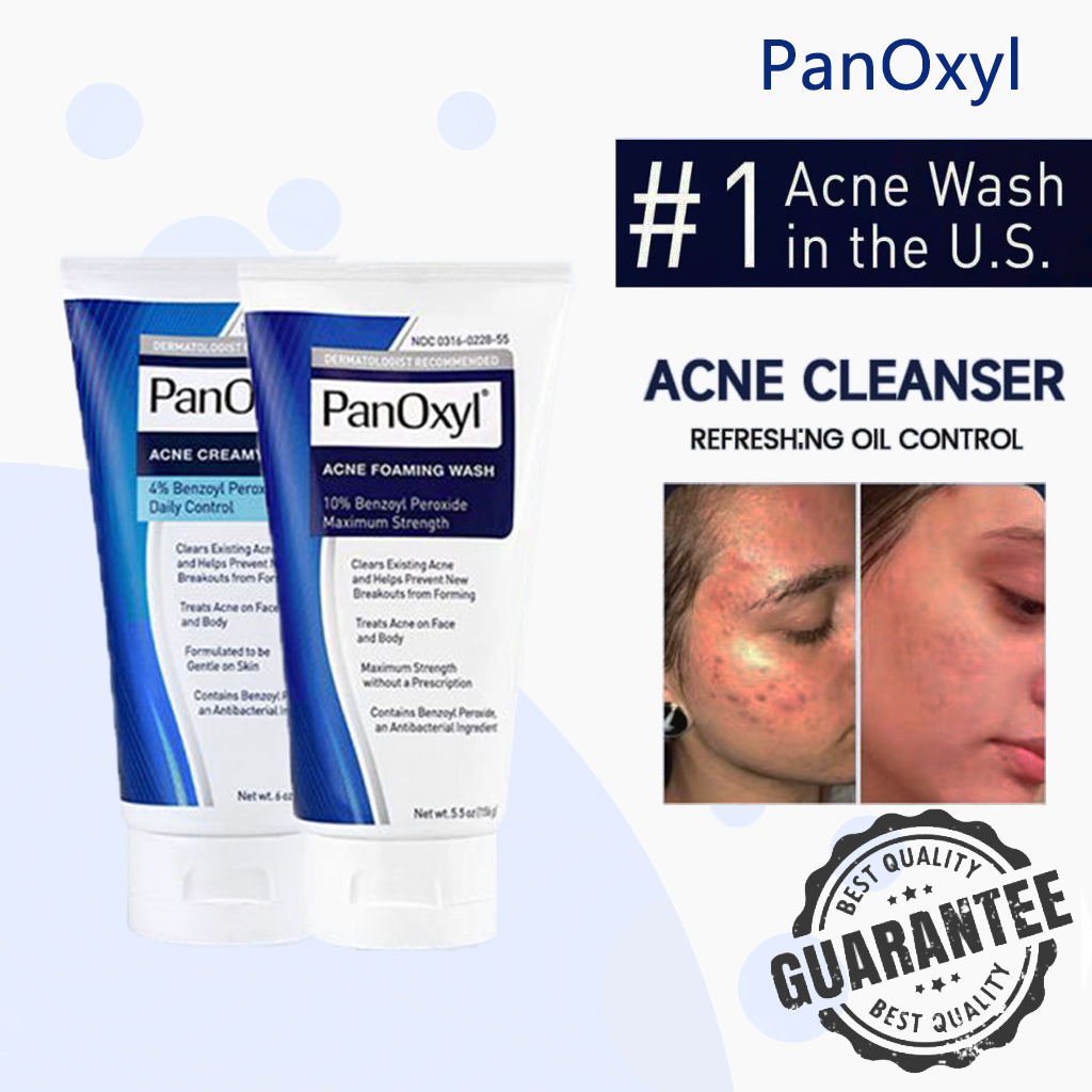 Panoxyl Acne Foaming Wash Benzoyl Peroxide 4and10 Gentle Cleanser Maximum Strength Facial 4290