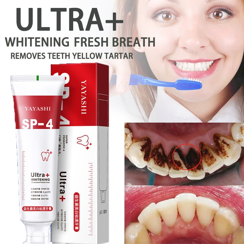 Toothpaste Whitening Remove Plaque Stains Oral Odor | Shopee Philippines