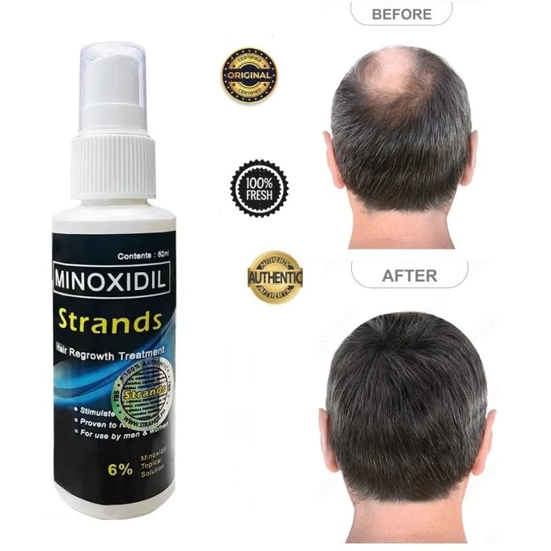 Original Minoxidil Strands 6% Minoxidil Premium Hair Grower Topical ...