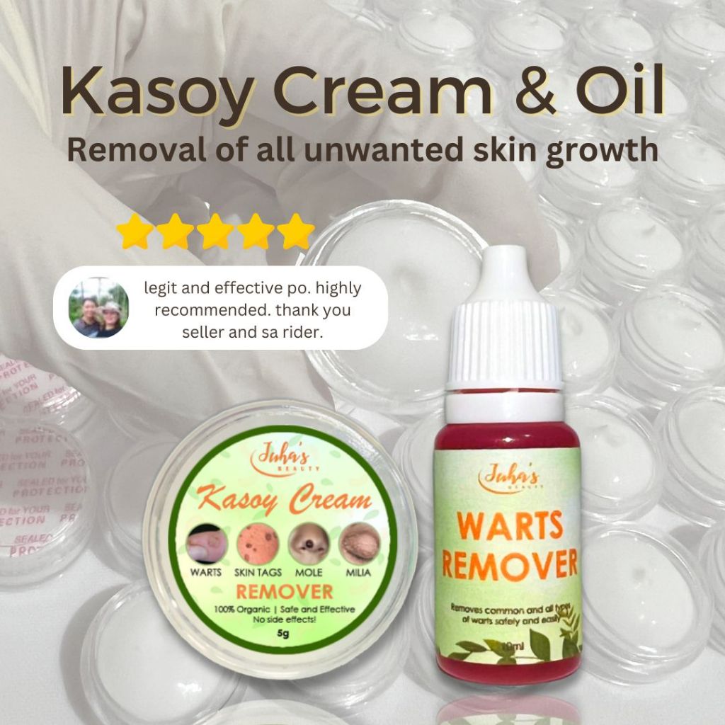 5g Kasoy Cream & 10ml Kasoy Oil | Warts and Mole Remover | Shopee ...