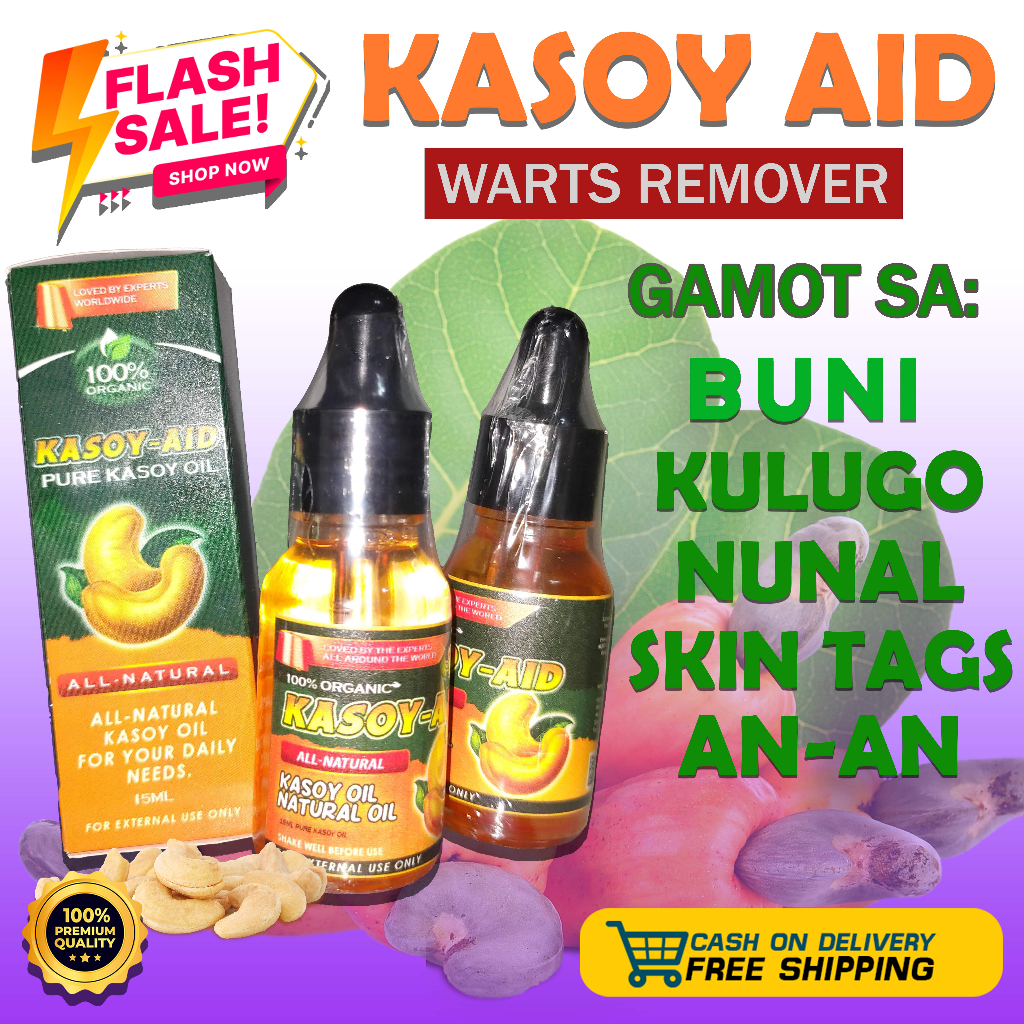 Warts Remover Original Pure Kasoy Oil Pantanggal ng Warts, Nunal, Skin ...