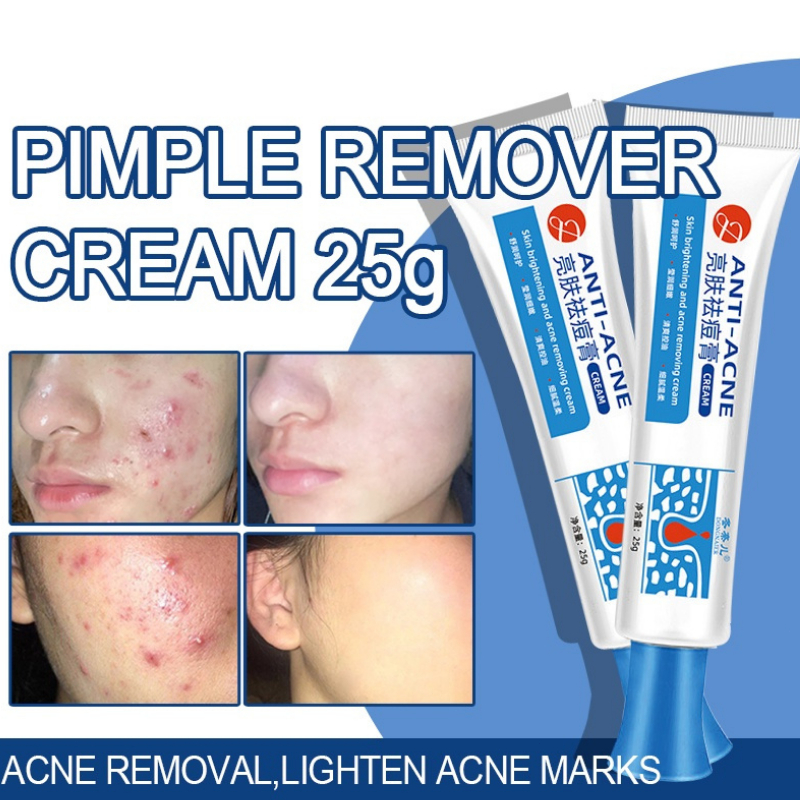 Acne Remover Cream Pimple Marks Remover Cream Acne Treatment Acne Scar