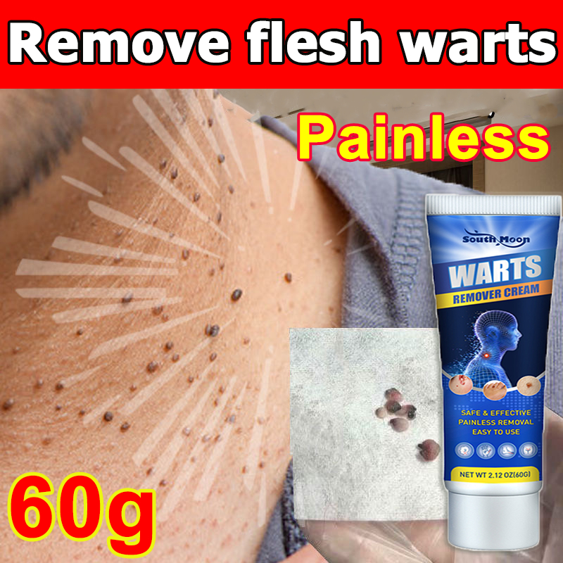 Warts Removal Cream Painless Genital Wart Remover Against Condyloma