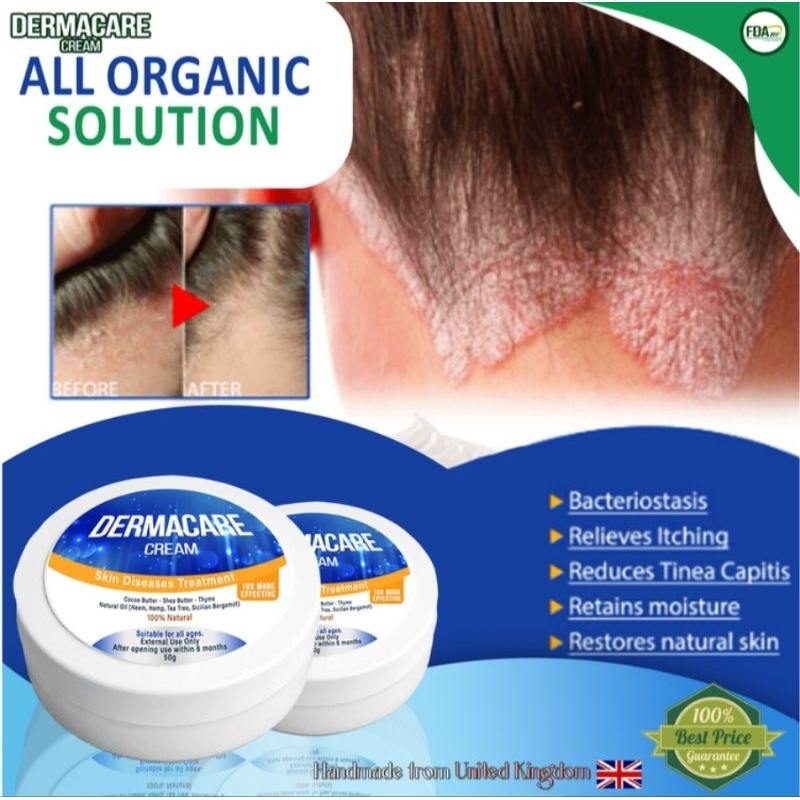 Dermacare Cream - Solution For All Types Of Skin Diseases | Shopee ...