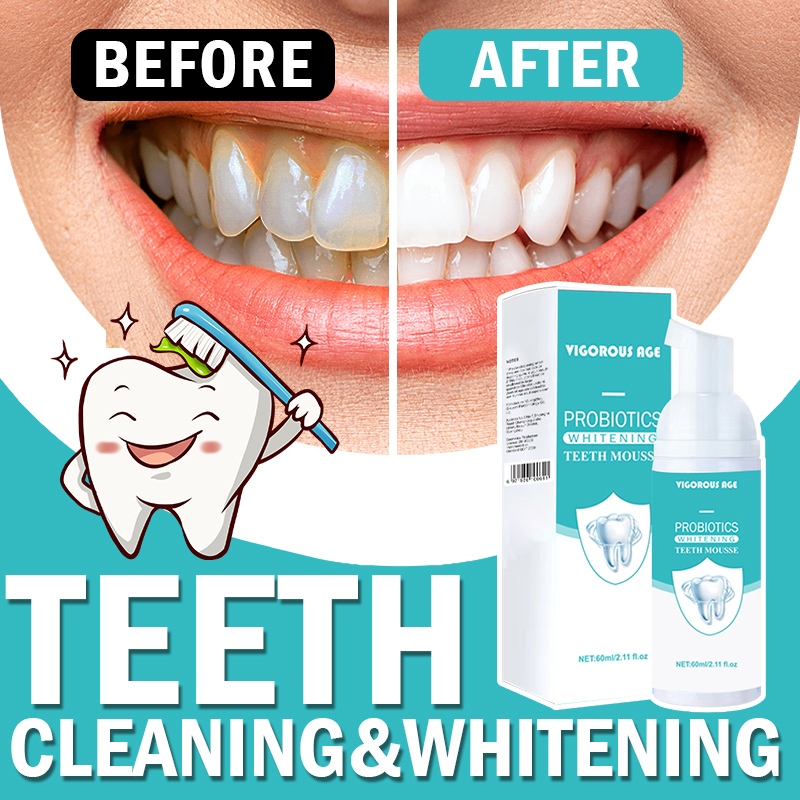 Teeth Whitening Toothpaste Mousse Mouthwash Remove Tartar Oral Care ...