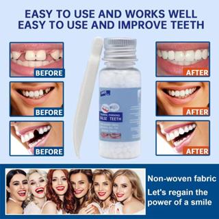 Shop moldable false teeth for Sale on Shopee Philippines