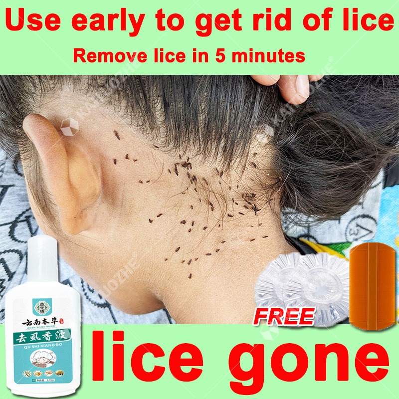 anti lice shampoo for kids lice removal shampoo 120ml Kills hair lice