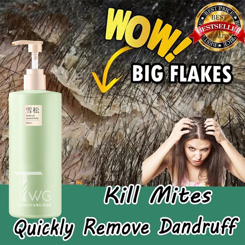 Anti dandruff shampoo hair treatment Dandruff remover Oil control 380ml