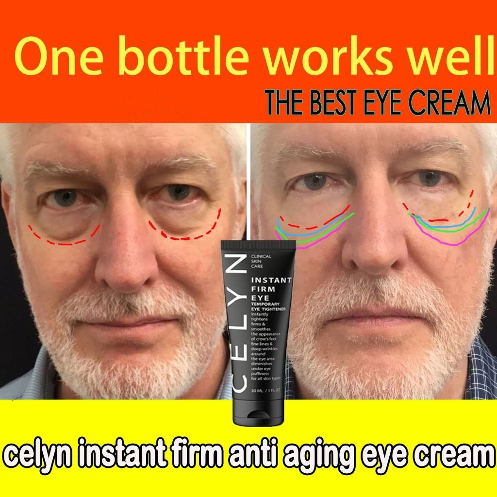 Celyn Instant Firming Eye Cream Anti Aging Eyebag Remover Reduce dark ...