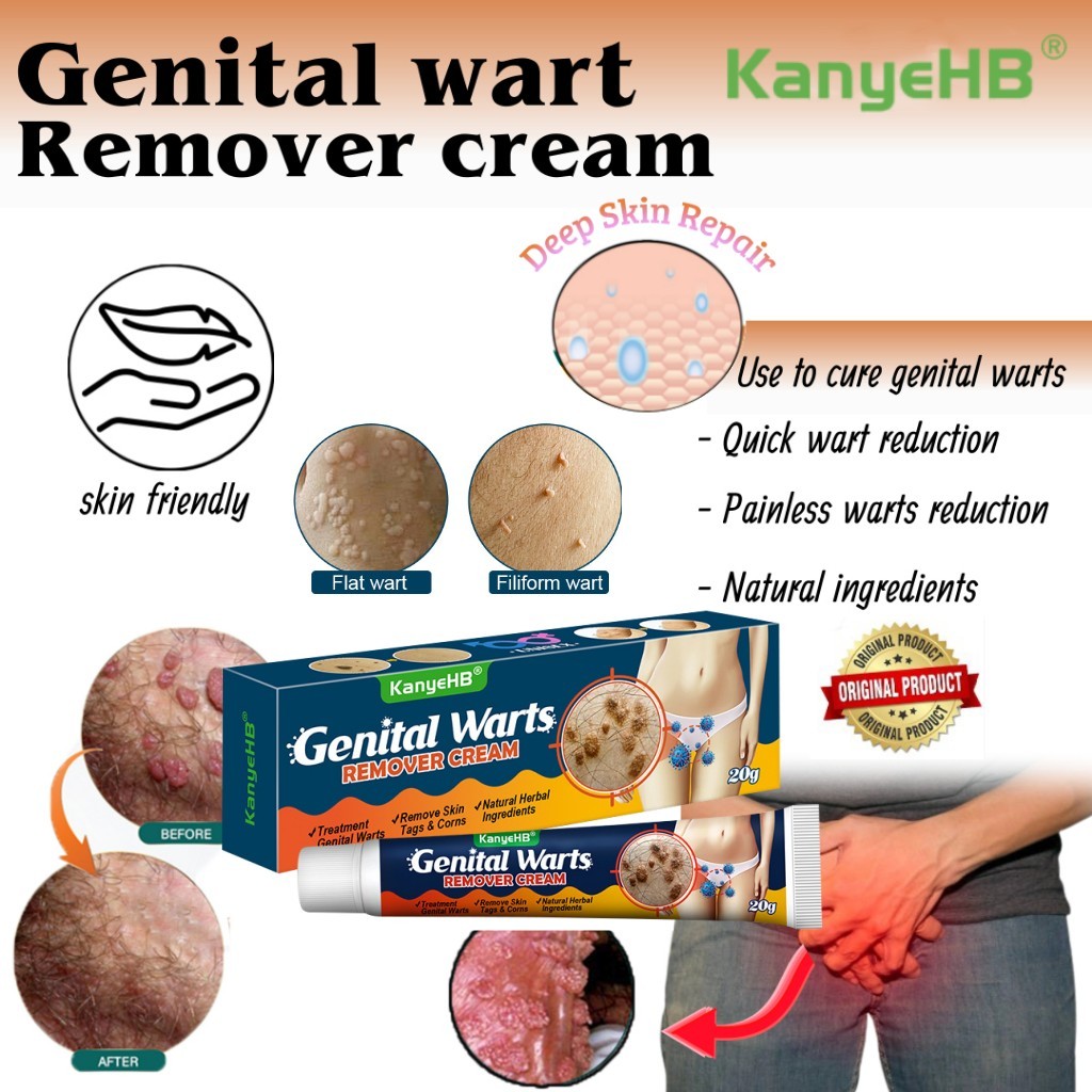 Kanyehb Genital Warts Remover Original Ointment Acne Treatment Neck Skin Flat Warts Remover 3233