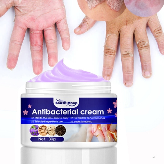 Antifungal Cream Athlete's Foot Cream for Beriberi ltching Tinea