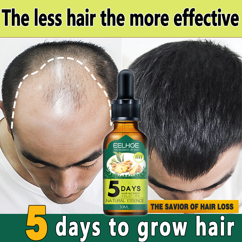 Hair Growth Serum 30ml Hair Grower Fast Long Hair Treatment Minoxidil