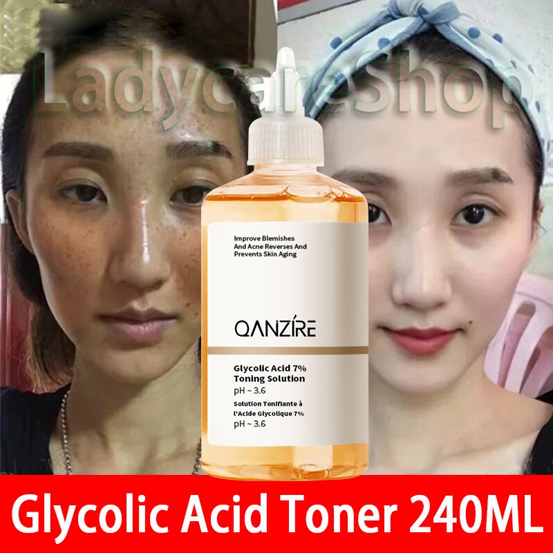 Facial Toner Glycolic Acid 7 Toning Solution Acne Pimple Marks Remover