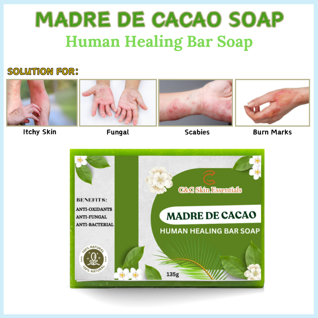 Madre De Cacao Soap for Human: 100% Natural and Organic Solution for ...