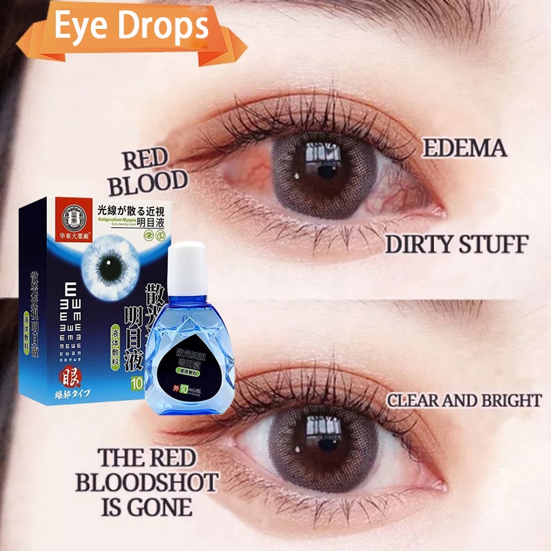 Eye Drops 10ml Japan Astigmatism Eye Drops Protect Eyesight for Clear