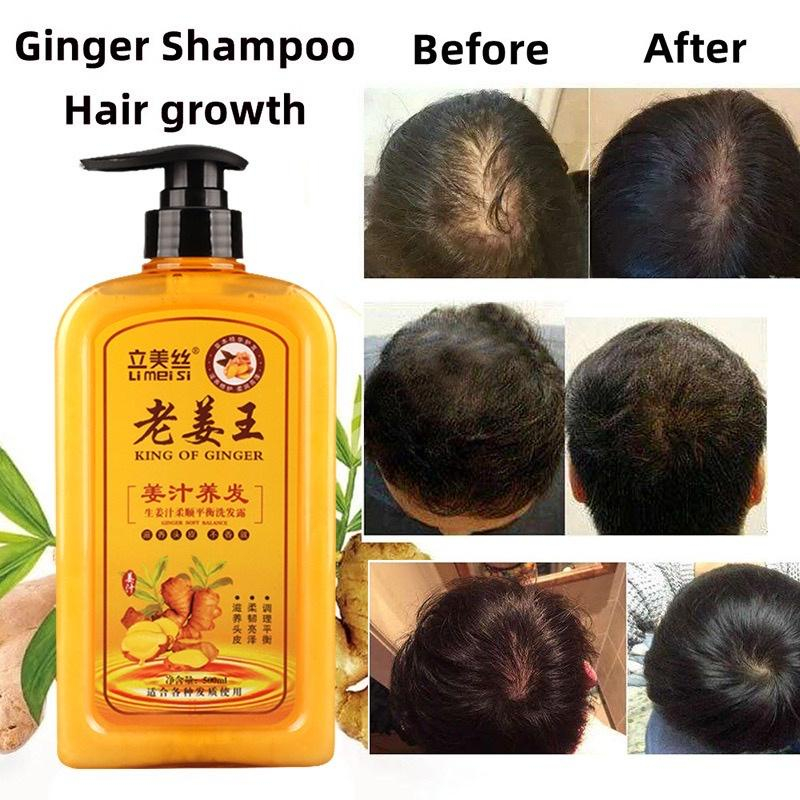 Azla Ginger Hair Shampoo Fast Regrowth Hair Thick Anti Hair Loss Anti Dandruff Anti Itching 5655