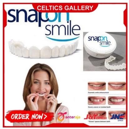 Original Top Bottom Instant Teeth Veneer | Snap On Smile Veneers ...