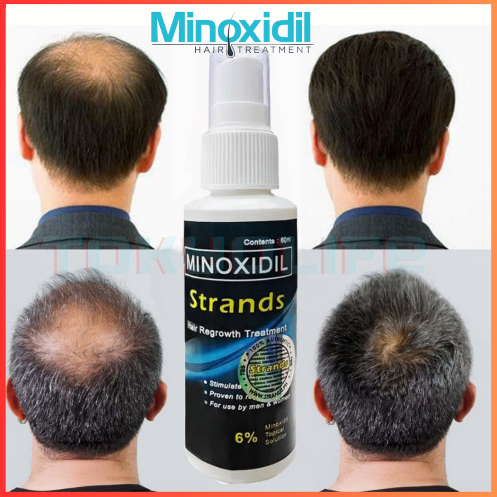 MINOXIDIL HAIR GROWER Original Minoxidil Strands 6% hair grower beard ...