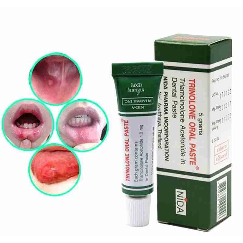 trinolone oral paste for mouth ulcer treatment / dentures sore | Shopee ...
