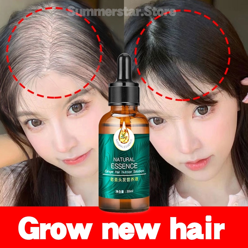 30ML Ginger Hair Growth Essential Oil Rapid Hair Growth Serum Anti Hair