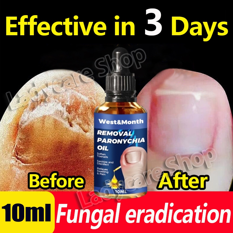 Nail Repair Essence Serum Anti Paronychia Relief Oil Fungal Treatment