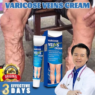 Advanced Clinicals Varicose Veins Treatment For Legs | Spider Vein &  Varicose Vein Cream | Collagen Cream | Vitamin K Cream | Arnica Cream 
