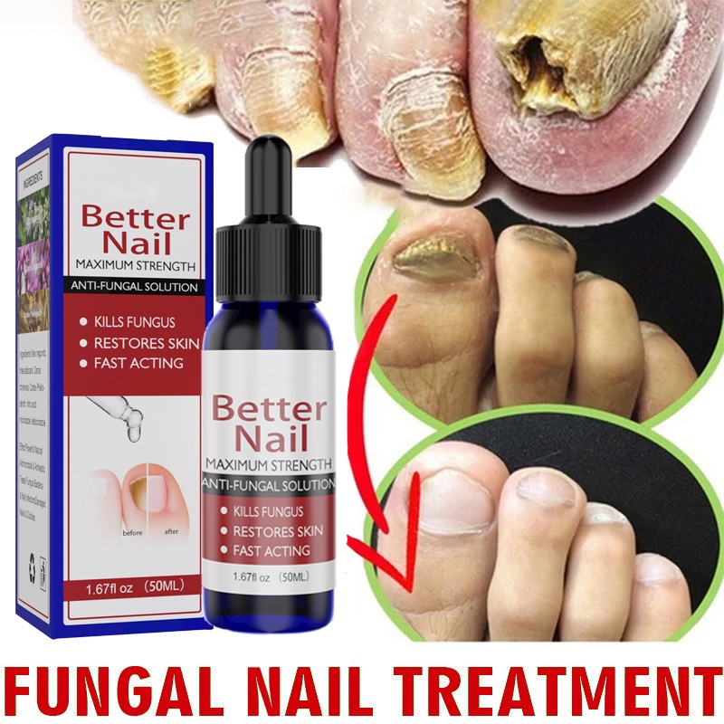 50ML Nail Repair Essence Serum Fungal Nail Treatment Anti Fungal Nail