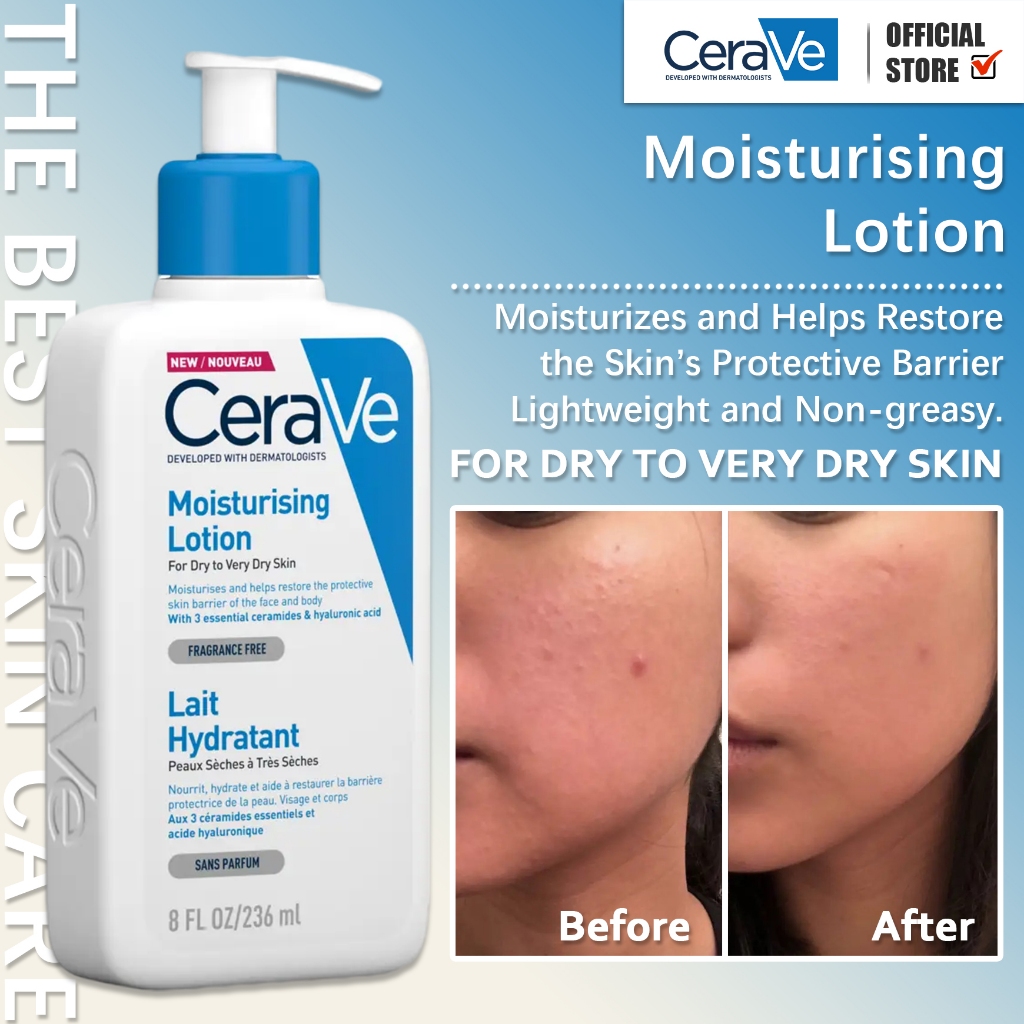 CeraVe Moisturizing Lotion Lait Hydratant Suitable For Dry Skin 236ml ...
