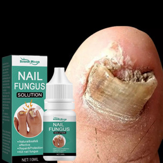 Nail Fungus Treatment Original Nail Anti Fungal Treatment Nail Fungus 