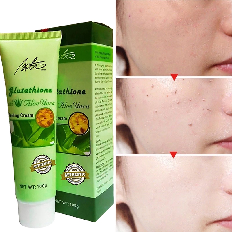 Glutathione with Aloe Vera Magic Peeling Cream Exfoliate 100g | Shopee ...