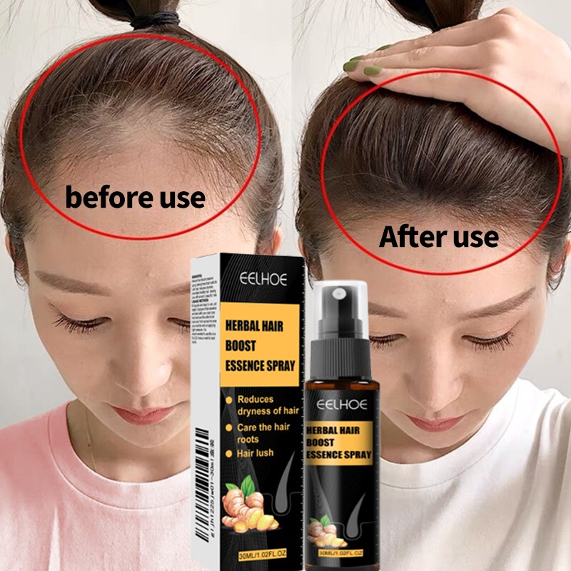 Hair Growth Serum Spray Anti Hair Loss Hair Nutrient Solution Fast Hair ...