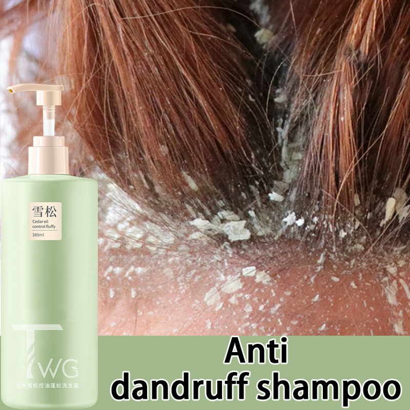 Anti dandruff shampoo lice shampoo 380ml oil control dry and frizzy