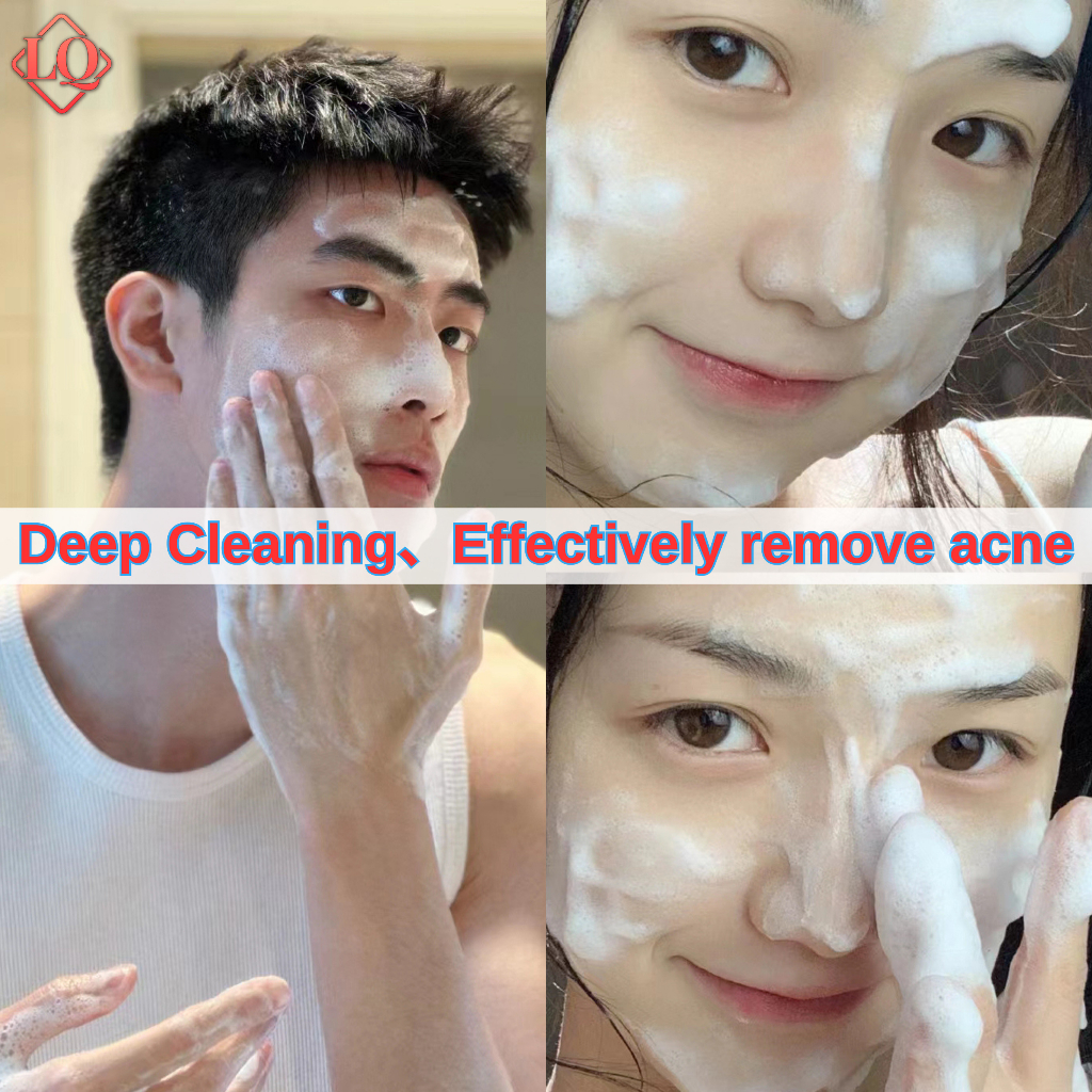 Acne facial wash whitening moisturizer remove blackheads skin care 100g