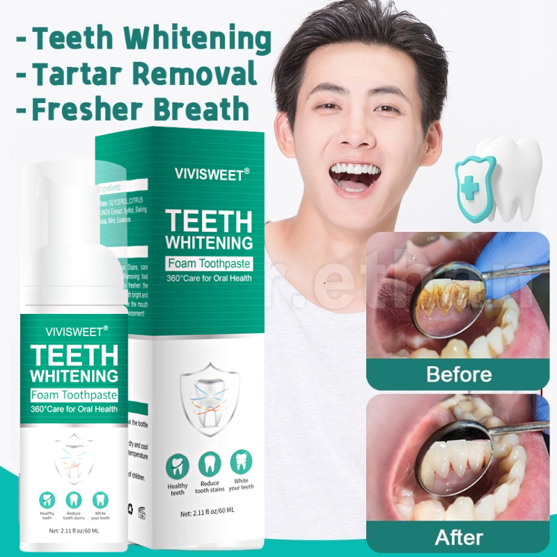 VIVISWEET Teeth Whitening Mousse Toothpaste Tartar Removal for Teeth ...