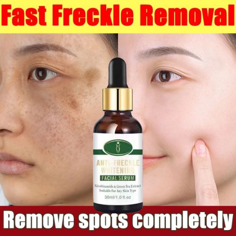 COD Acne Cream Acne Treatment Facial Serum Removal Scar Essence ...