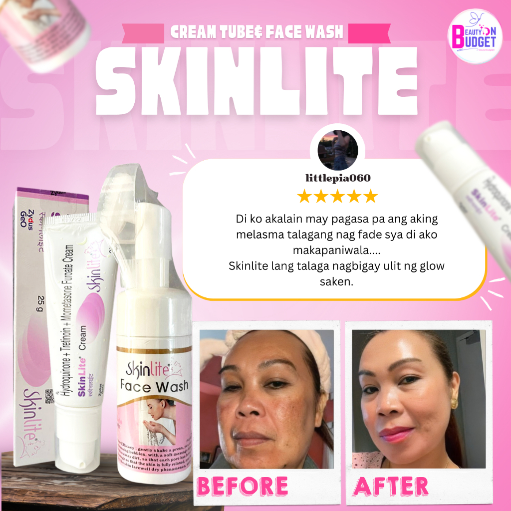 SKINLITE Cream and FACIAL FOAM WASH Combo | Shopee Philippines