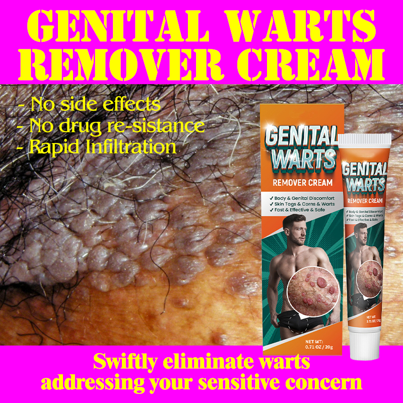 Warts Remover Cream Private Parts Genital Wart Skin Tags Papillomas