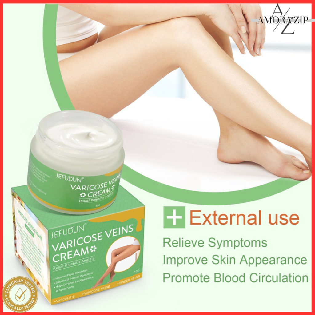 SEFUDUN Varicose Veins Cream, Soothing Relief for Veins pain and Spider ...